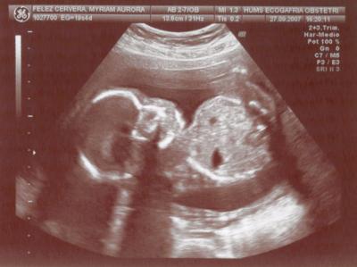 20070928124438-samuel.jpg